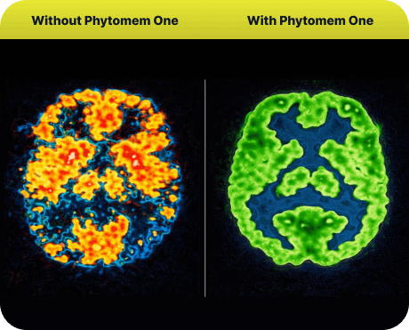brain before and after